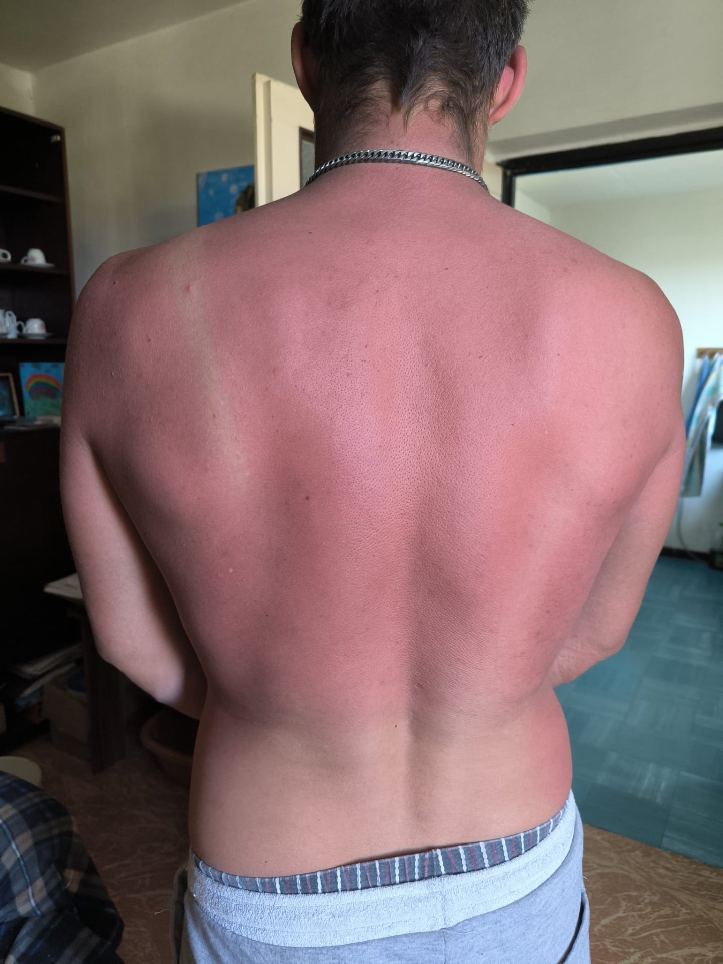 Foto 1